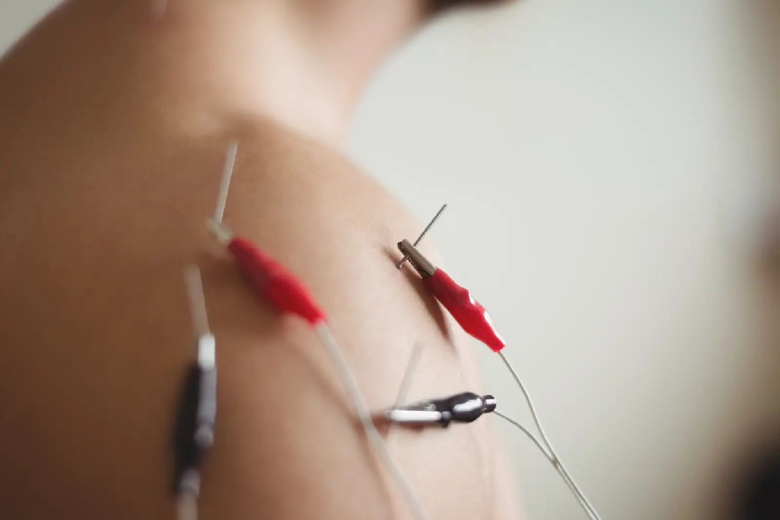 Praticien medecine chinoise Praticien medecine chinoise